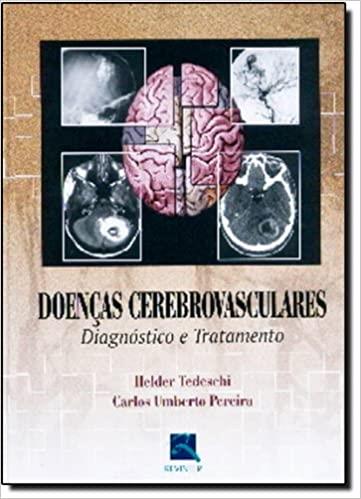 Doencas Cerebrovasculares Diagnostico E Tratamento