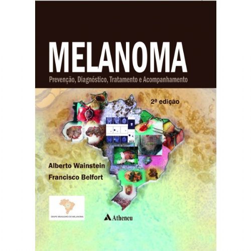 Melanoma - Prevencao, Diagnostico, Tratamento E Acompanhamento