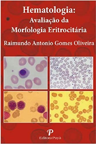 Hematologia - Avaliação Da Morfologia Eritrocitária - Pranchas