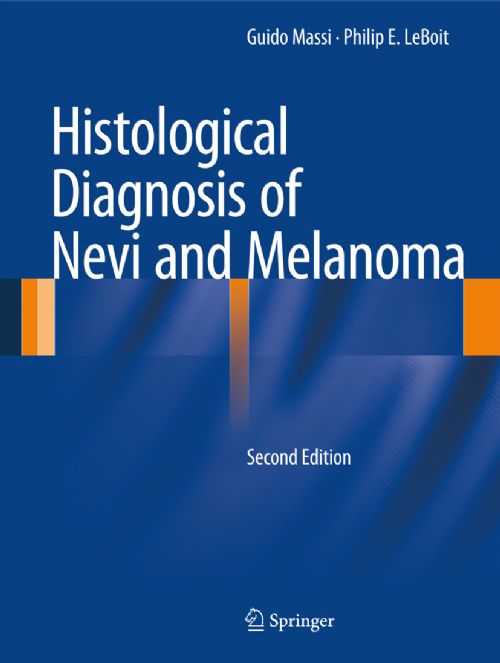 Histological Diagnosis Of Nevi And Melanoma