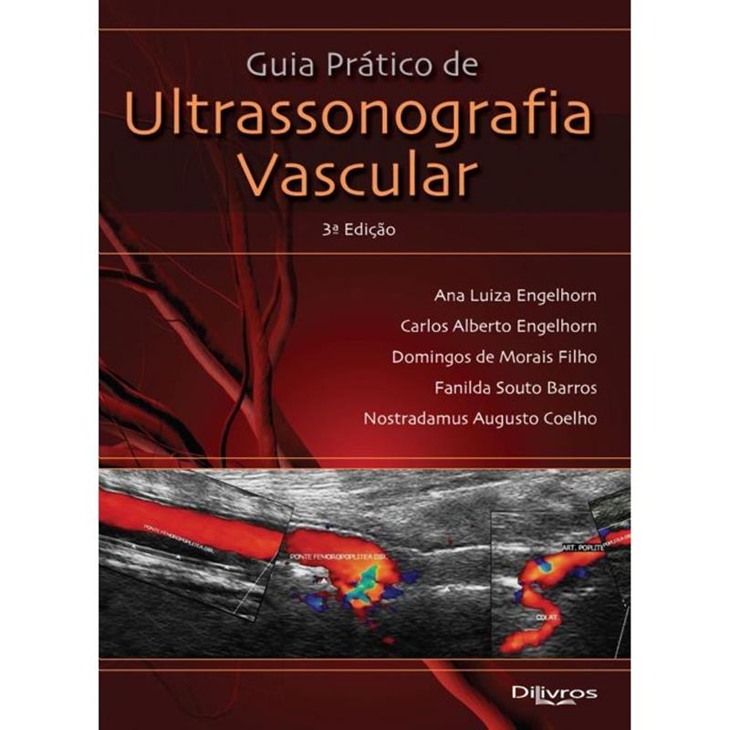 Guia Pratico De Ultrassonografia Vascular