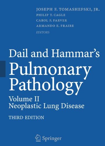 Dail And Hammars Pulmonary Pathology V2