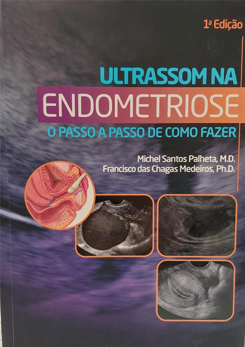 Ultrassom Na Endometriose O Passo
