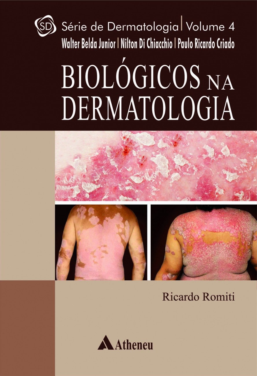 Biologicos Na Dermatologia  Vol 4  Serie Dermatologia