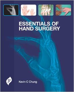 Essentials Of The Hand Surgery