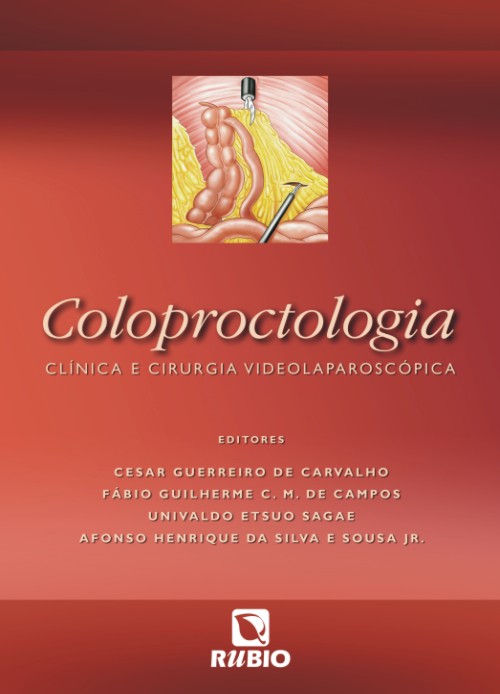 Coloproctologia - Clinica E Cirurgia Videolaparoscopica