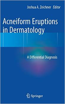 Acneiform Eruptions In Dermatology