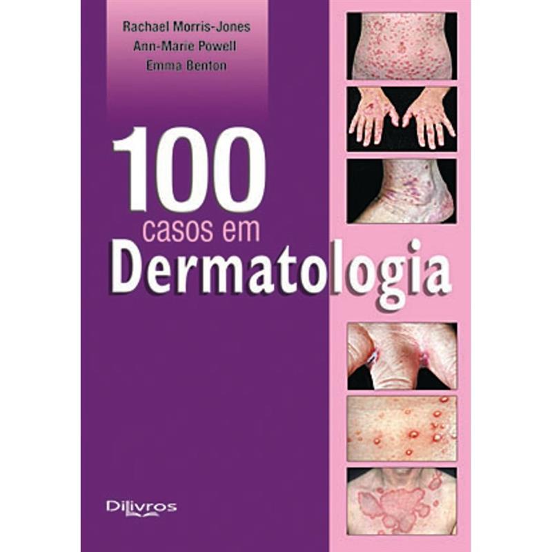 100 Casos Em  Dermatologia