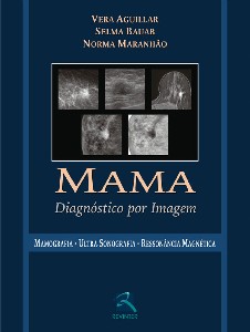 Mama Diagnóstico Por Imagem