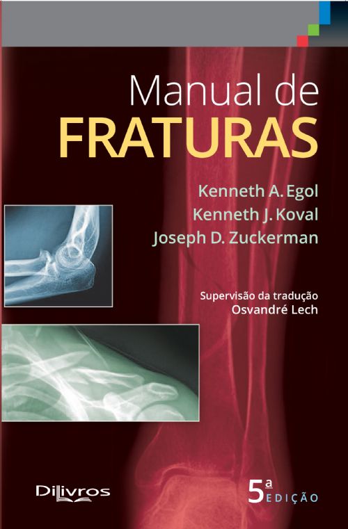 Manual De Fraturas