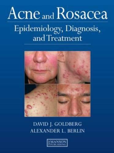 Acne And Rosacea  Epidemiology, Diagnosis And Treatment