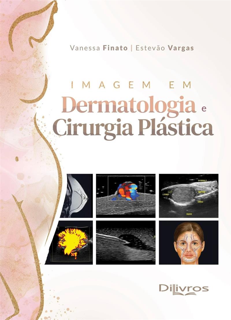 Imagem Em Dermatologia E Cirurgia Plástica