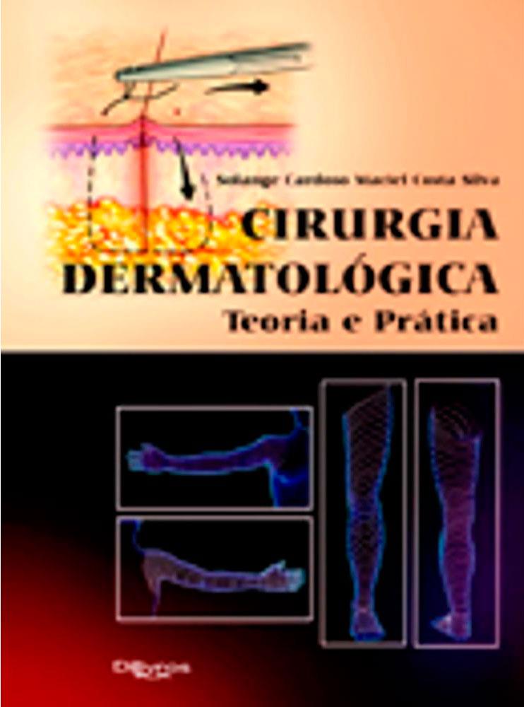 Cirurgia Dermatologica Teoria E Pratica