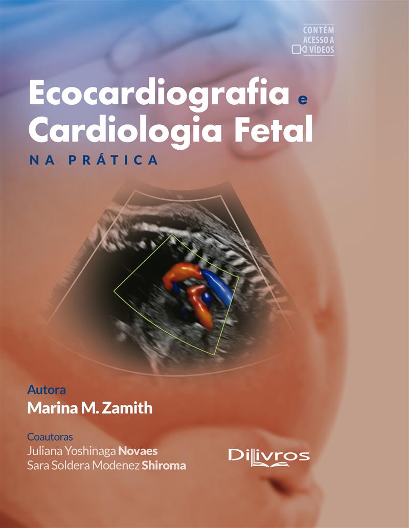 Ecocardiografia E Cardiologia Fetal E Pratica