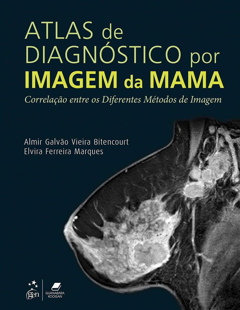 Atlas De Diagnostico Por Imagem Da Mama