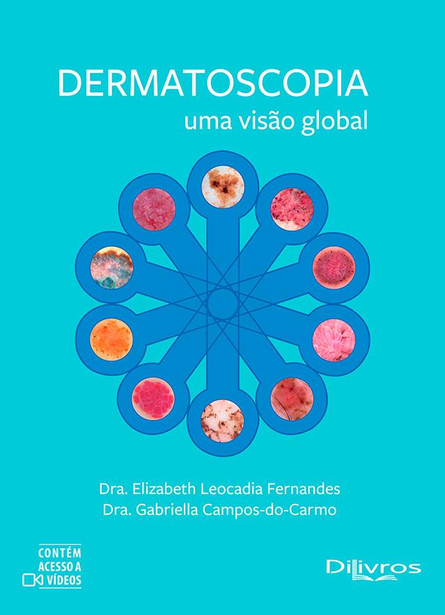 Dermatoscopia Uma Visao Global