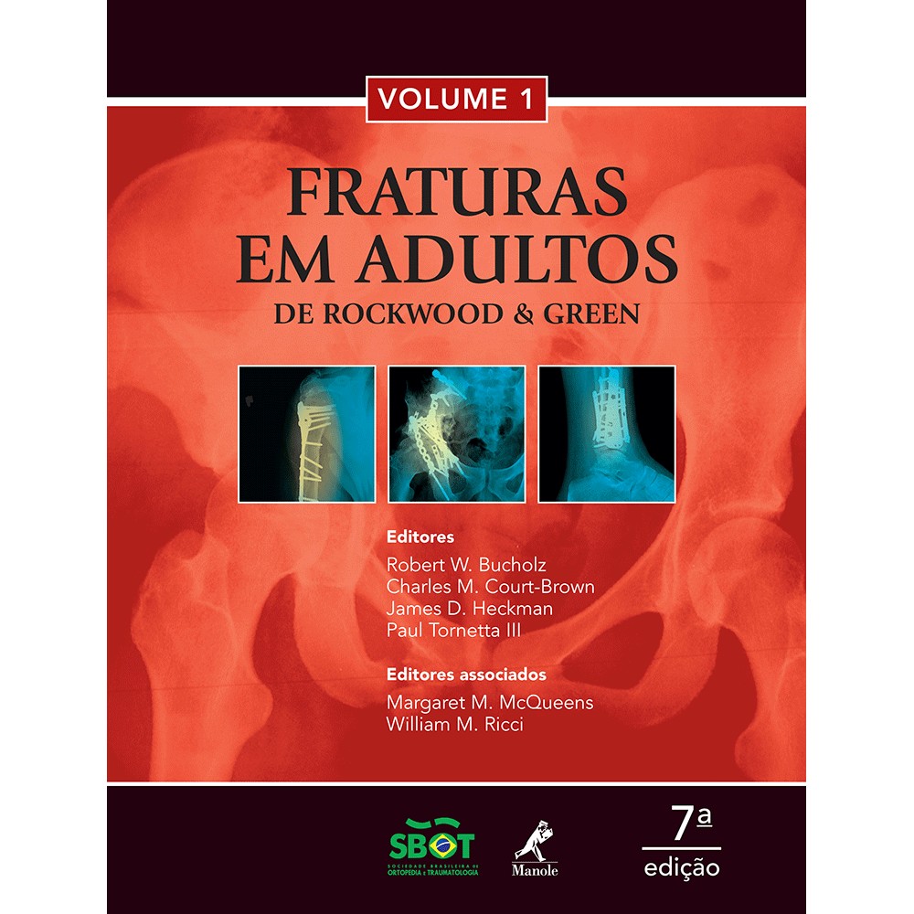 Fraturas Em Adultos  De Rockwood E Green (2 Volumes)