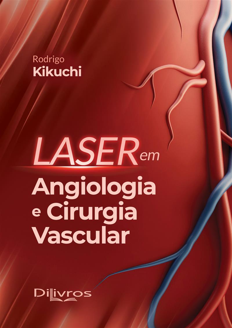 Laser Em Angiologia E Cirurgia Vascular
