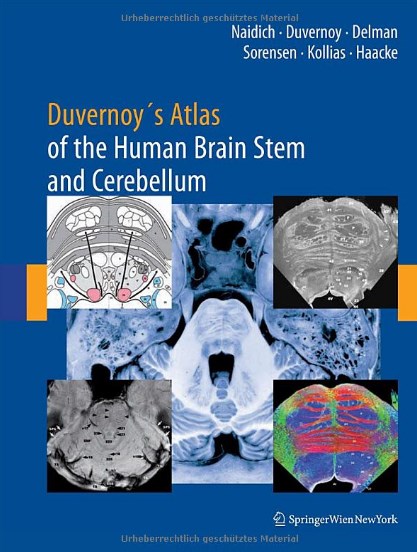 Duvernoys Atlas Of The Human Brain Stem And Cerebellum