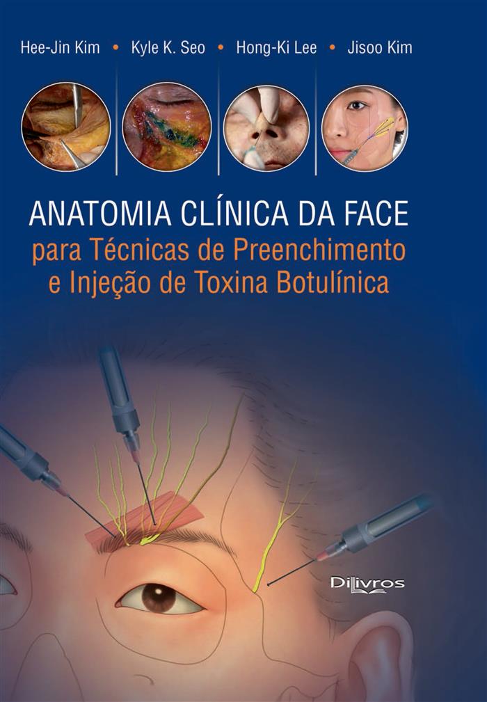 Anatomia Clinica Da Face Para Tec De Preench E Inj De Toxina Botulinica