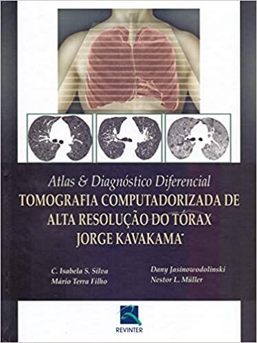 Atlas & Diagnostico Diferencial - Tomografia Computadorizada De Alta Resolu