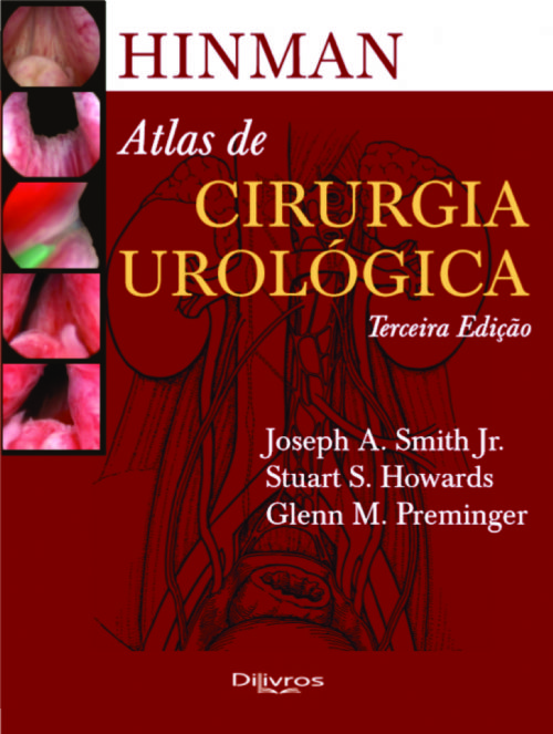 Atlas De Cirurgia Urologica