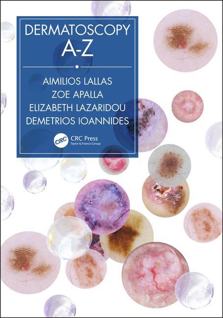 Dermatoscopy A-z  (brochura)