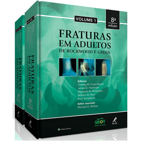 Fraturas Em Adultos De Rockwood E Green: 2 Volumes