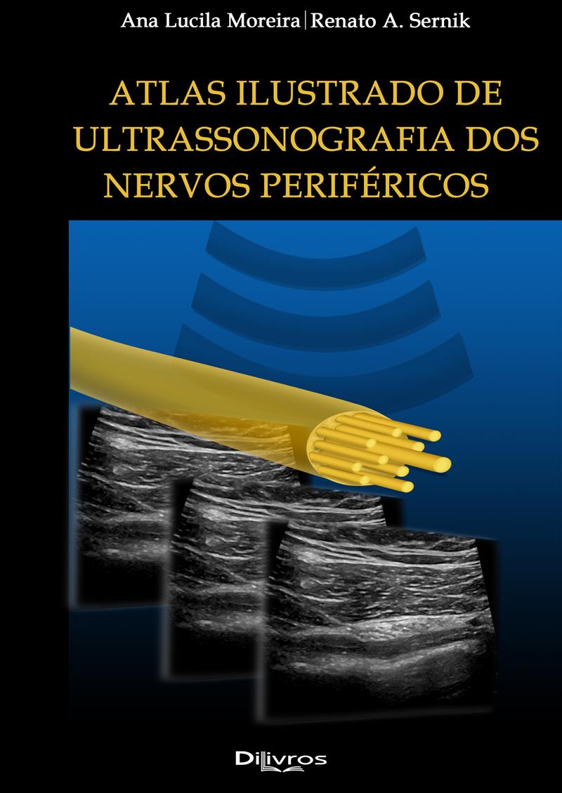 Atlas Ilustrado Ultrassonografia Dos Nervos Periféricos
