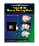 A Combined Mri And Histology Atlas Of The Rhesus Monkey Brain In Stereotaxi