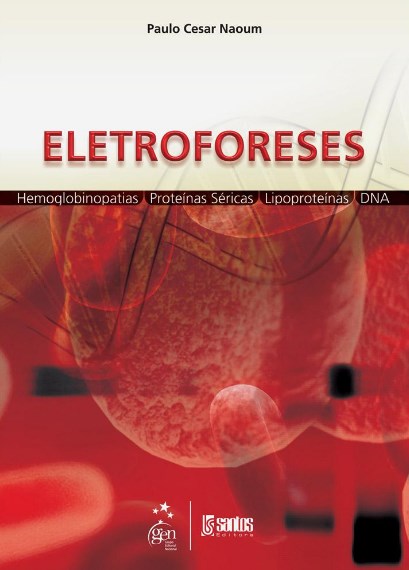 Eletroforeses - Hemoglobinopatias, Proteínas Séricas, Lipoproteínas