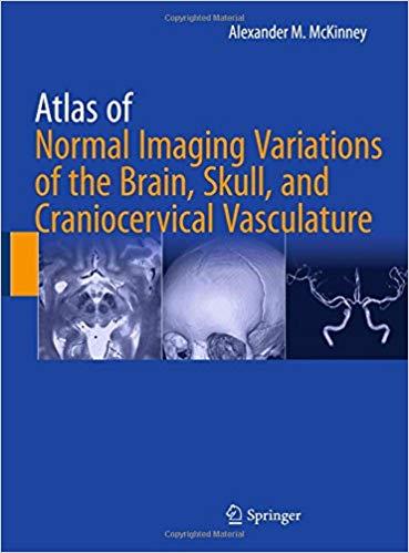Atlas Of Normal Imaging Variations Of The Brain Skull, And Craniocervical