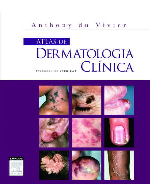 Atlas De Dermatologia Clinica