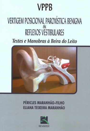 Vertigem Posicional Paroxistica Benigna - Reflexos Vestibulares Vppb