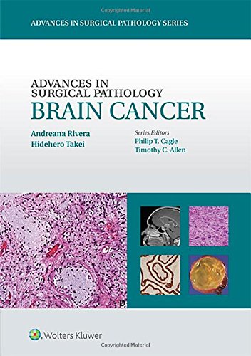 Advances In Surgical Pathology: Brain Cancer