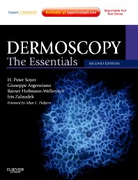 Dermoscopy - The Essentials
