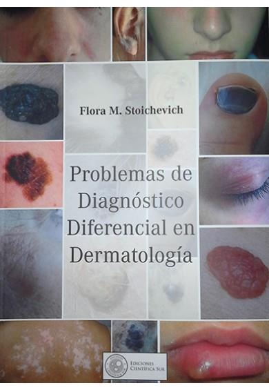 Problemas De Diagnostico Diferencial En Dermatologia (espanhol)