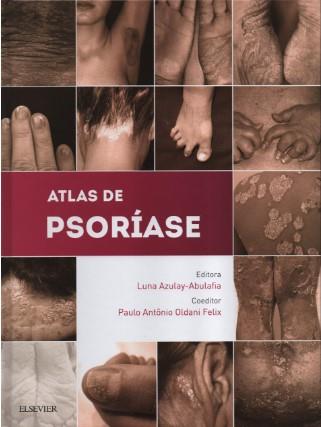 Atlas De Psoriase