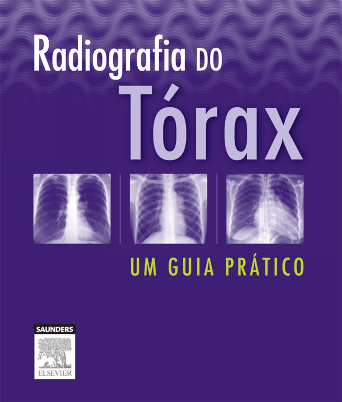 Radiografia Do Tórax: Um Guia De Sobrevivência