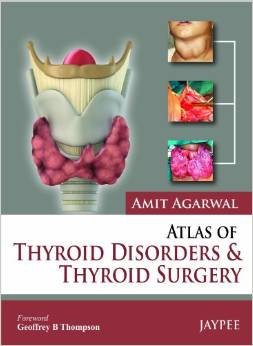Atlas Of Thyroid Disorders And Thyroid Surgery