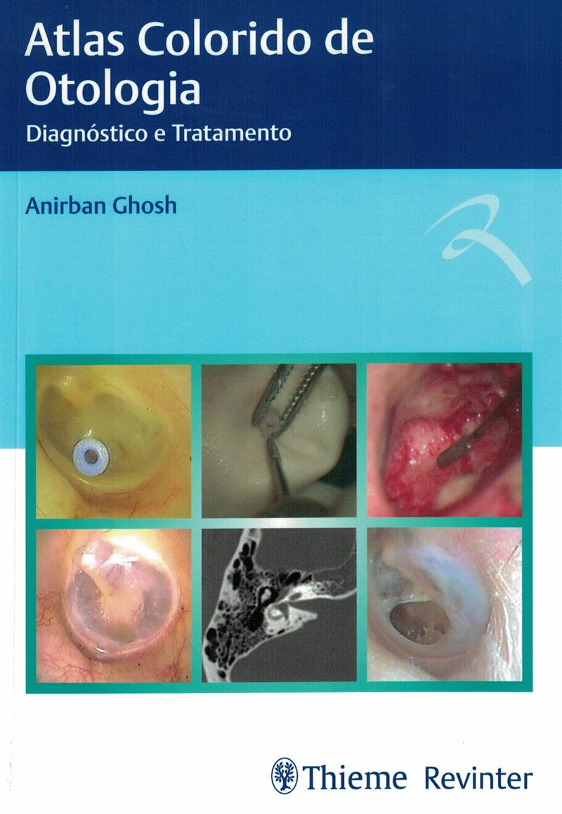 Atlas Colorido De Otologia: Diagnostico E Tratamento