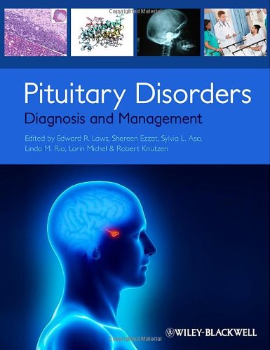 PITUITARY DISORDERS DIAGNOSIS AND MANAGEMENT, 9780470672013 - Di Livros ...