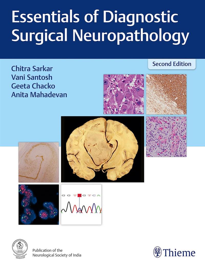 Essentials Of Diagnostic Surgical Neuropathology