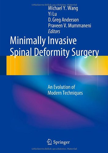 Livro - Minimally Invasive Spinal Deformity Surgery - Wang, M., Lu, Y ...