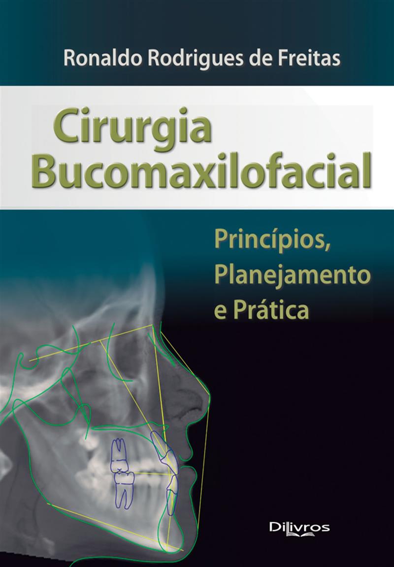 Livro - Cirurgia Bucomaxilofacial - Ronaldo Rodrigues De Freitas