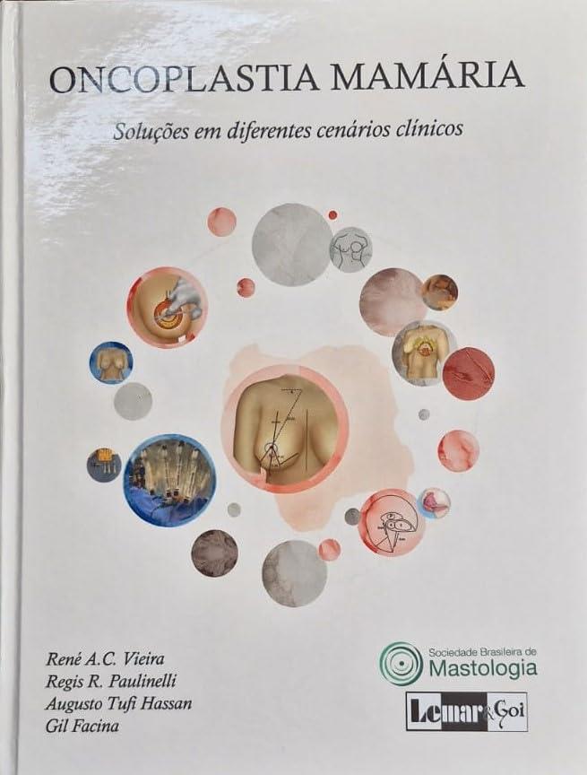 Oncoplastia Mamária: Soluções Em Diferentes Cenarios Clínicos