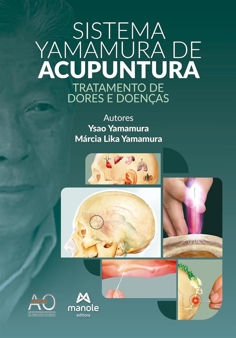 Sistema Yamamura De Acupuntura: Tratamento De Dores E Doenças