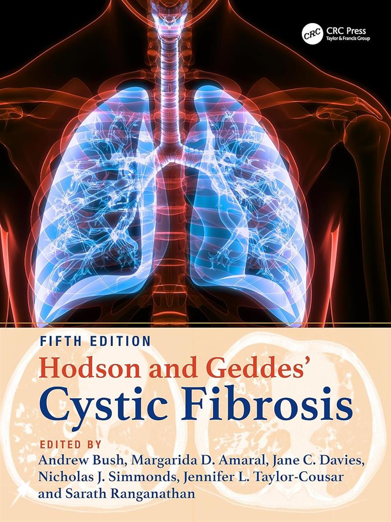 Hodson And Geddes Cystic Fibrosis