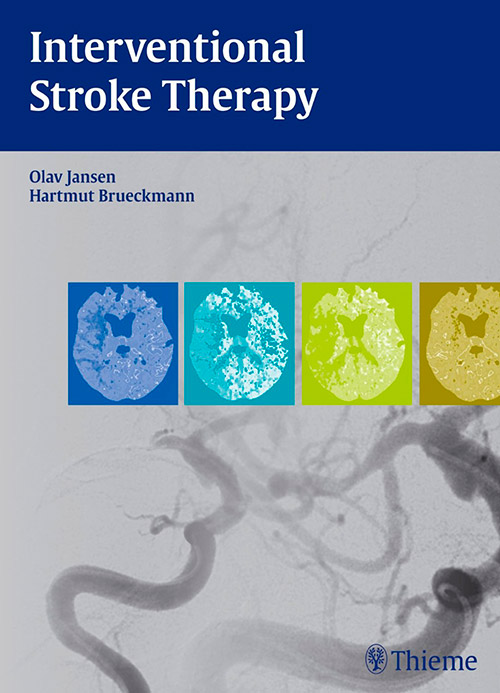 Livro - Interventional Stroke Therapy . - Jansen