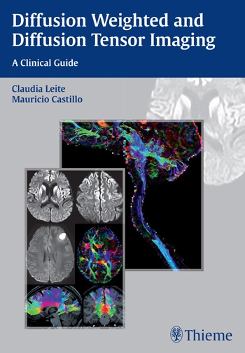 medinria diffusion weighted imaging